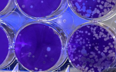 The truth about food safety in hot environments amidst E.coli outbreak concerns